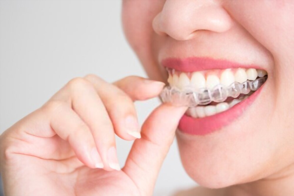 INVISALIGN NEDİR?