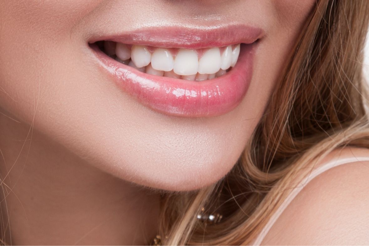 Estetik Ortodontide Gizli Diş Telleri Dışında Başka Yöntemler Var mıdır?