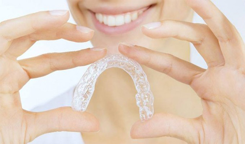 Clear Aligner