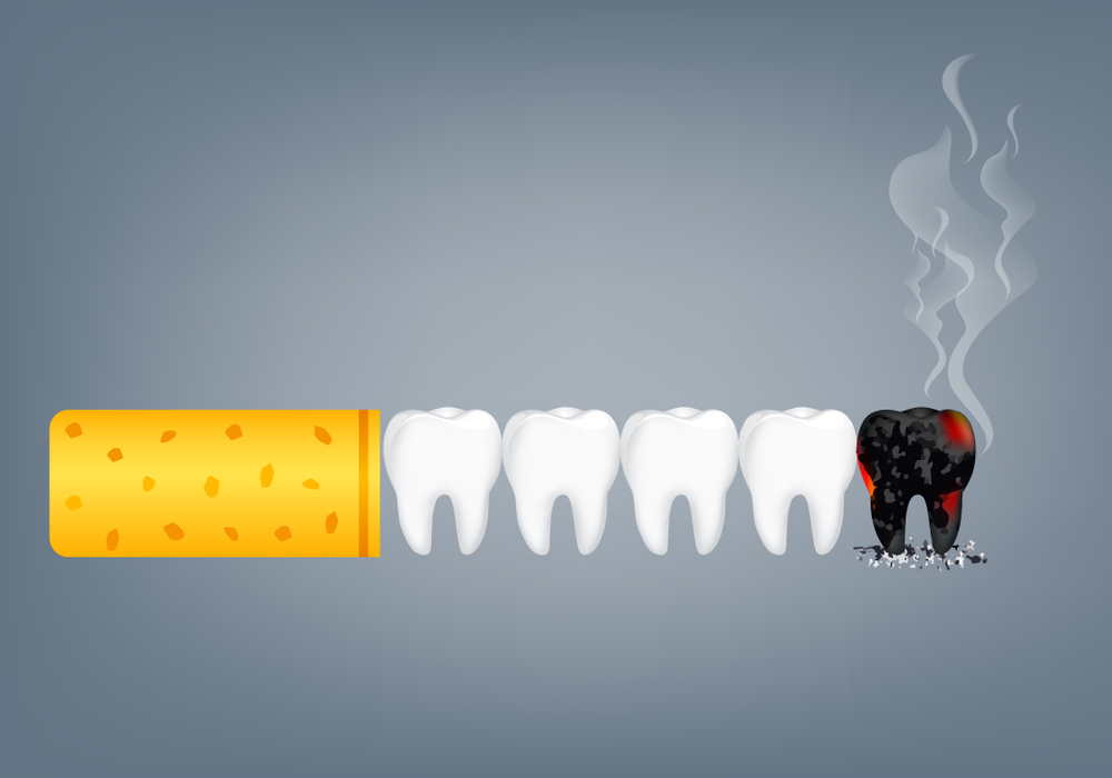 Sigara Kullanımının Diş Sağlığı Üzerine Etkisi