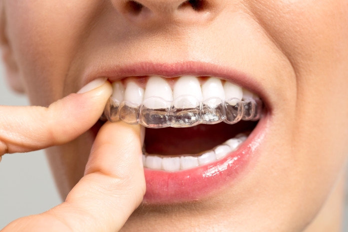 CLEAR ALIGNER