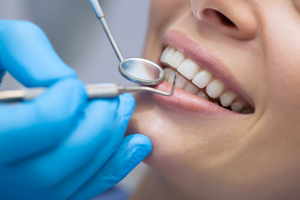 Lingual Ortodonti’de Gömük Kanin Dişlerin Tedavisi