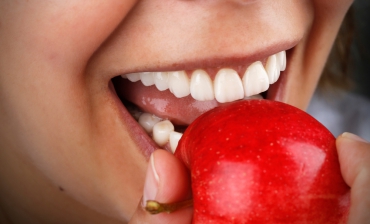 Zirkon Diş Tedavileri ve Lingual Ortodonti