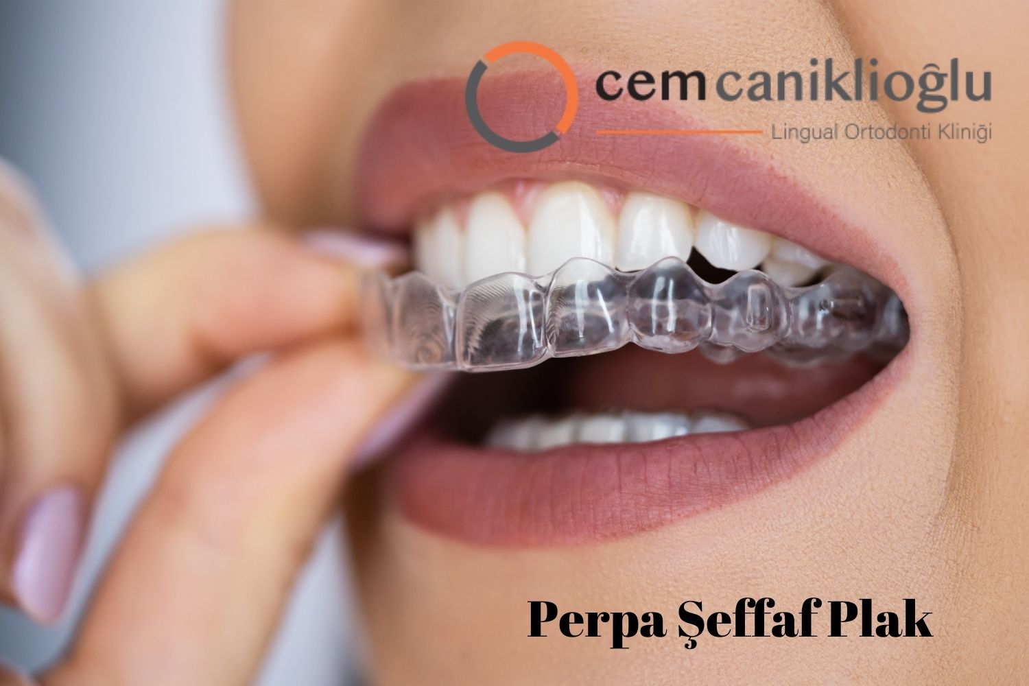 Perpa Şeffaf Plaklar