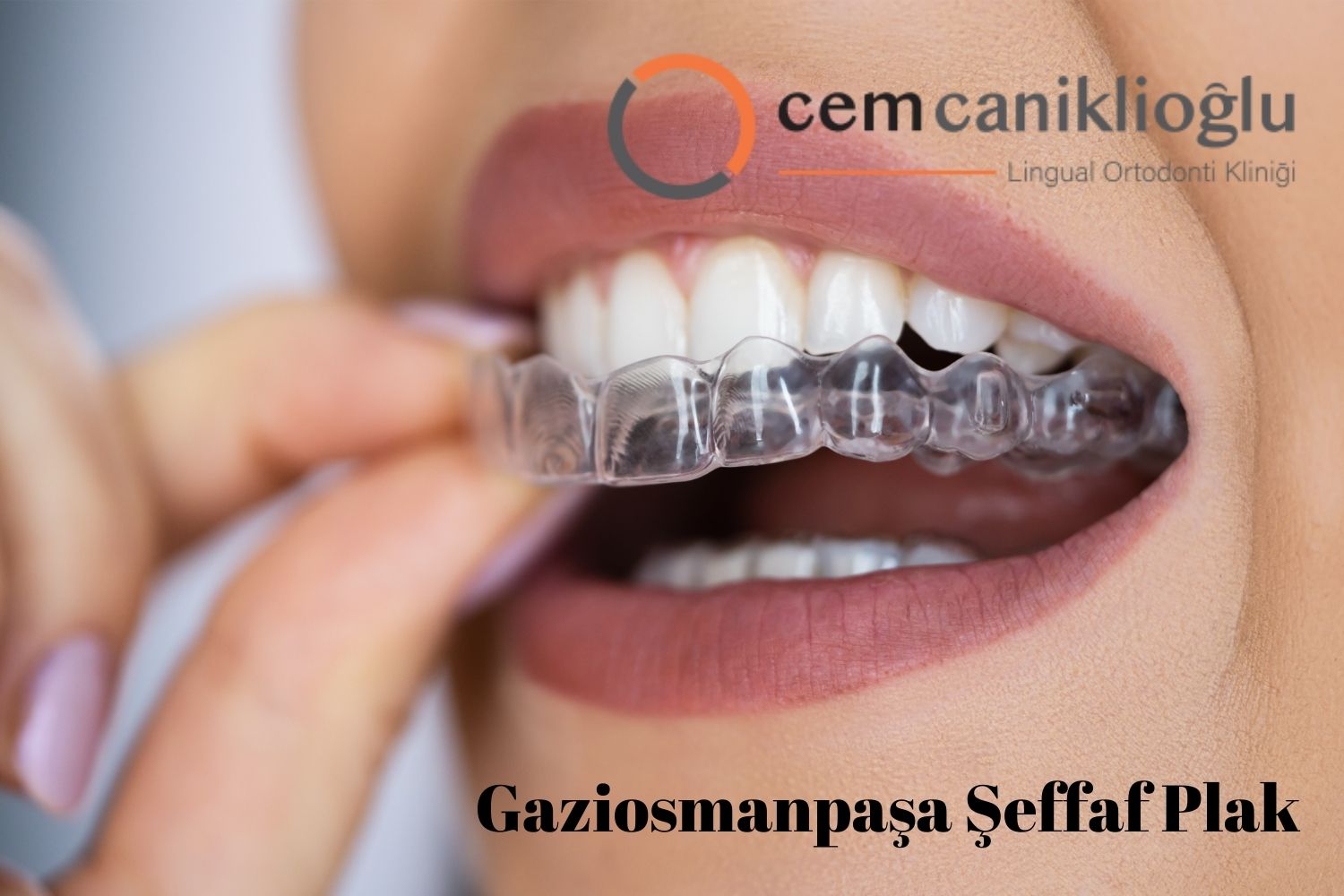 Gaziosmanpaşa Şeffaf Plak Fiyatları
