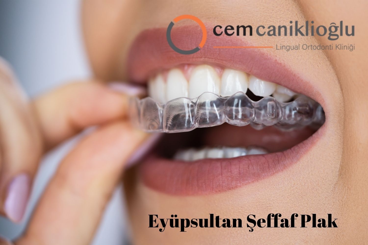Eyüp Şeffaf Plak Tedavisi